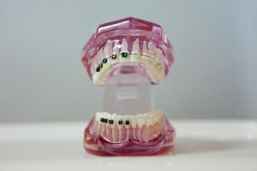 aparate de ultima generatie aparat dentar cluj